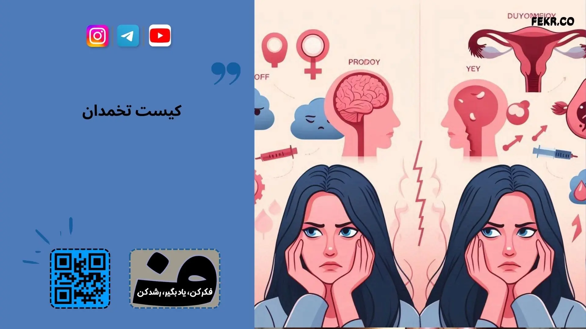 داروی متفورمین برای زنان مبتلا به سندرم پلی کیستیک موثر است؟
