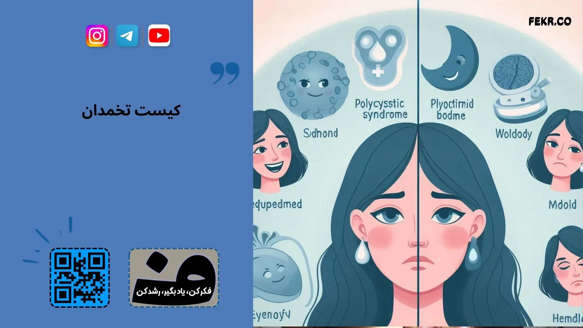 چاقی باعث سندرم پلی کیستیک است یا سندرم پلی کیستیک باعث چاقی؟