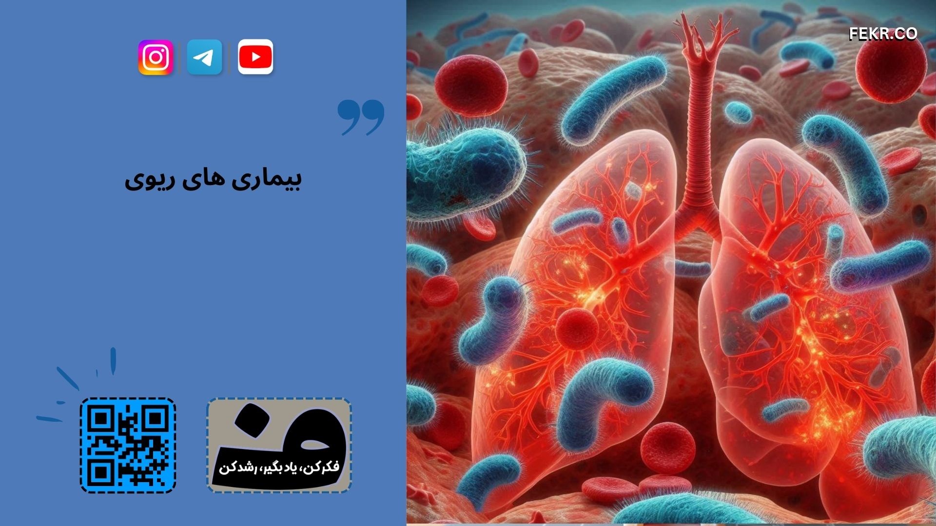 ذات الریه یا پنومونی