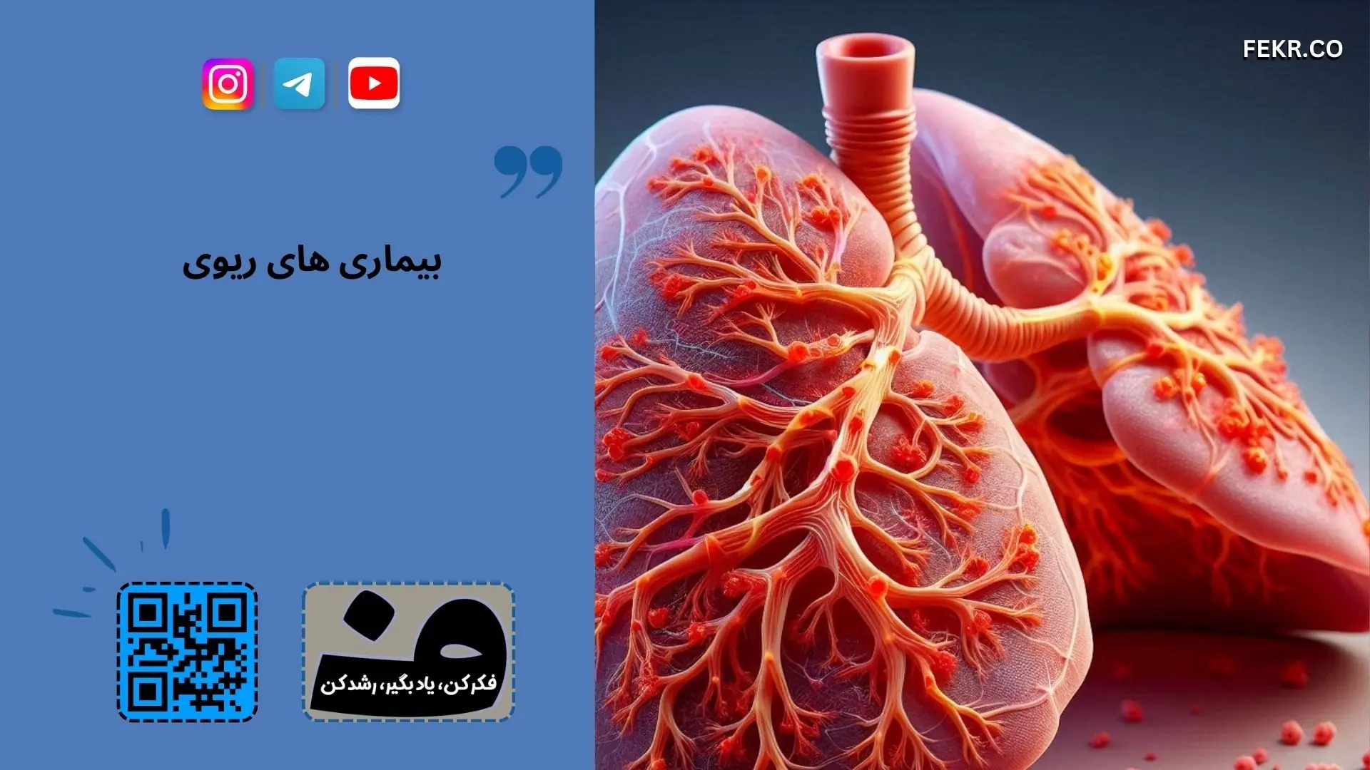 ذات الریه چقدر خطرناک است؟