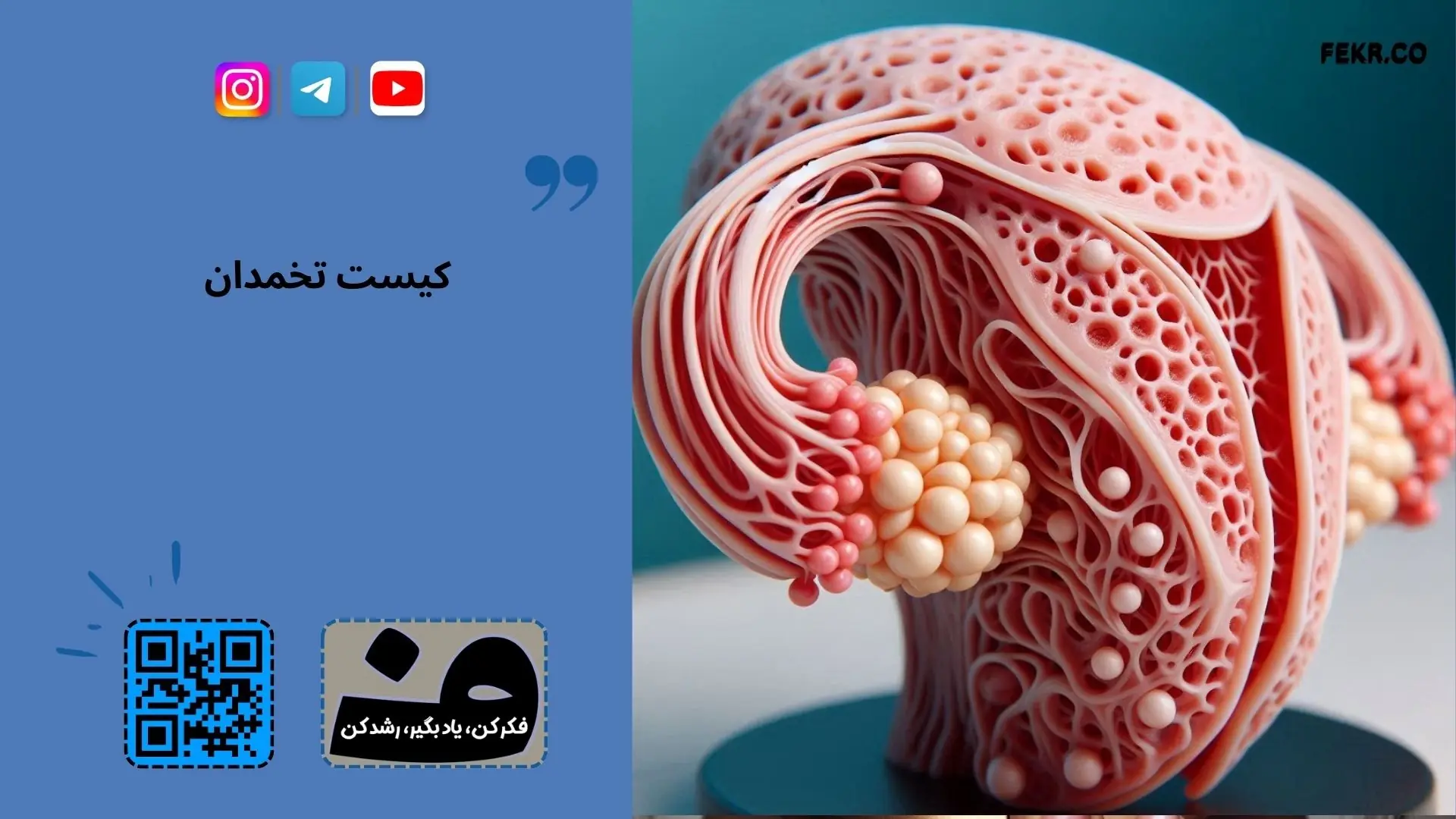 فواید و مضرات قرص متفورمین در زنان مبتلا به سندرم پلی کیستیک
