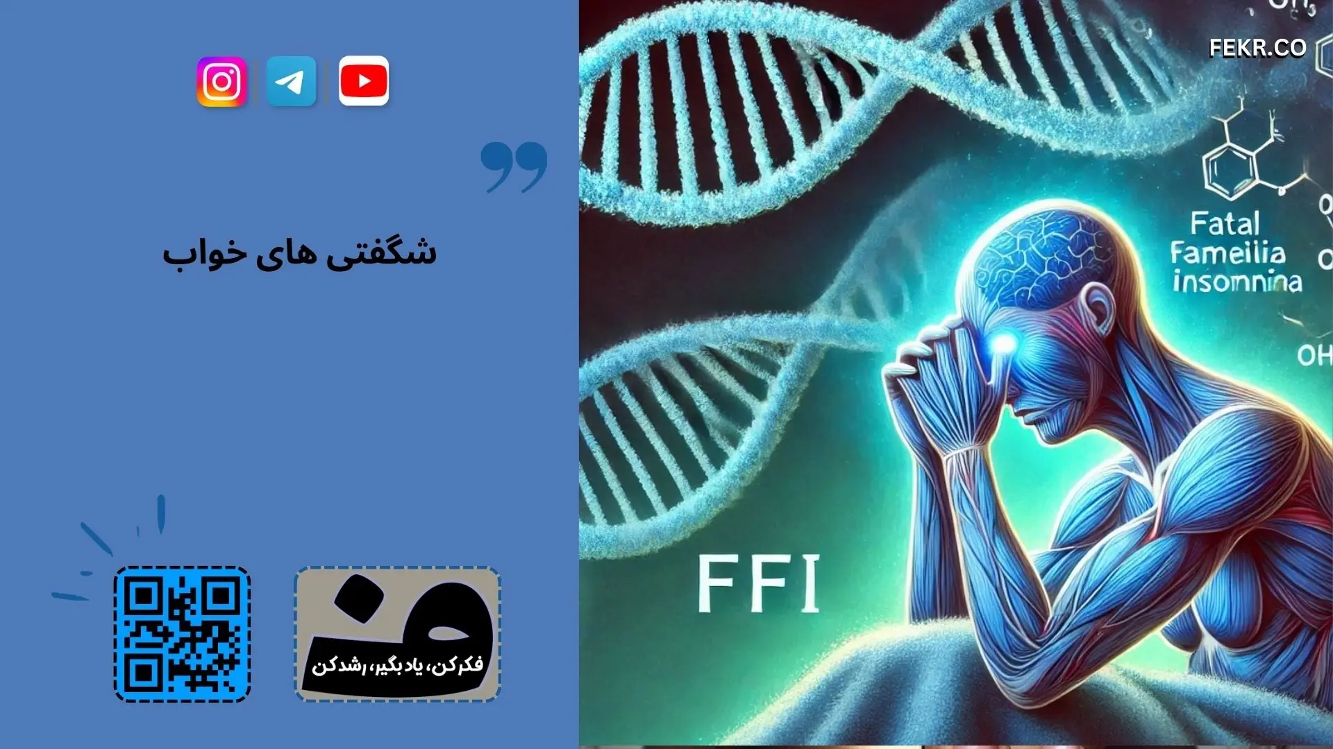 بی خوابی خانوادگی کشنده (Fatal Familial Insomnia)