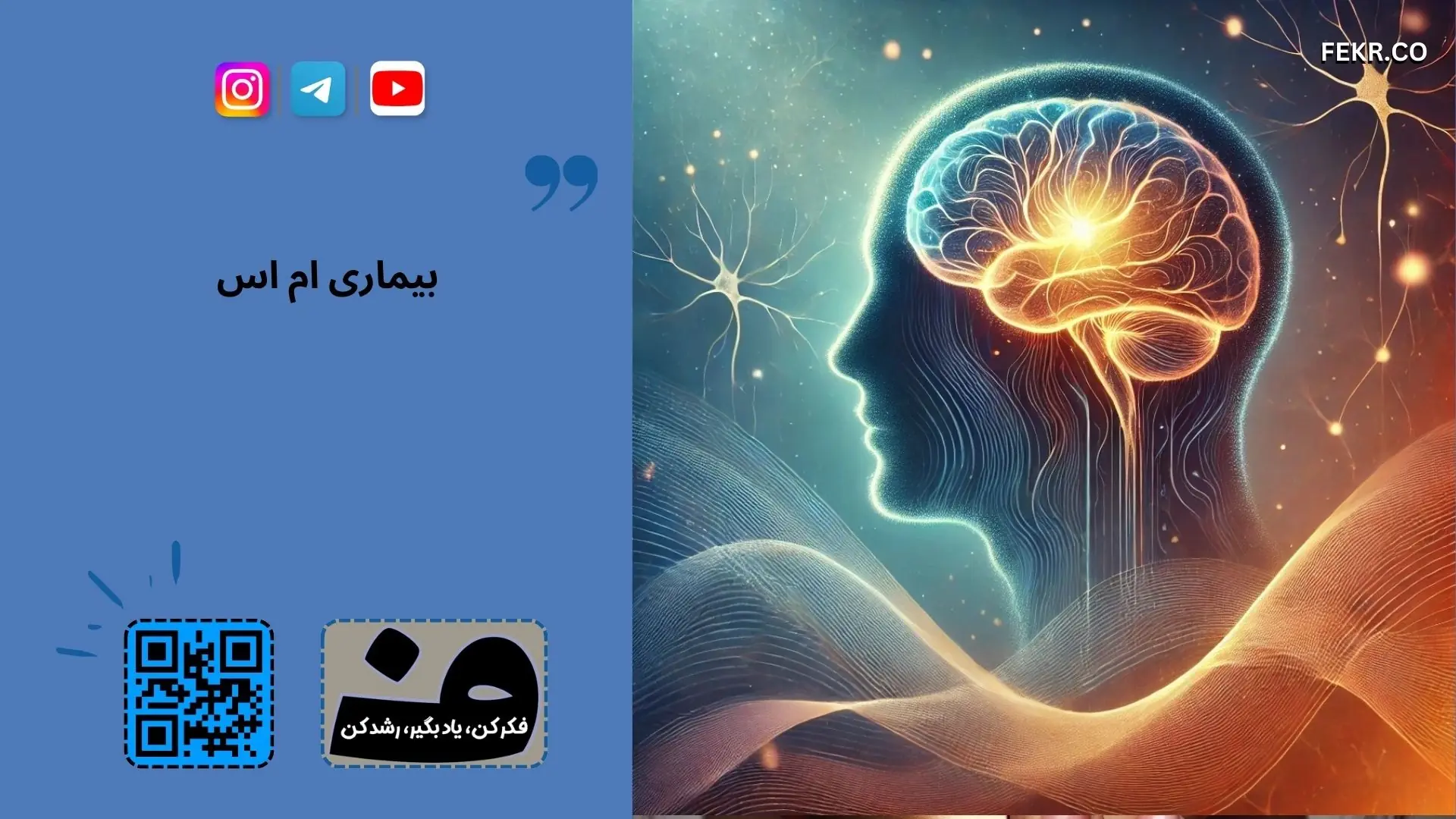 بیماری ام اس قابل پیشگیری است؟