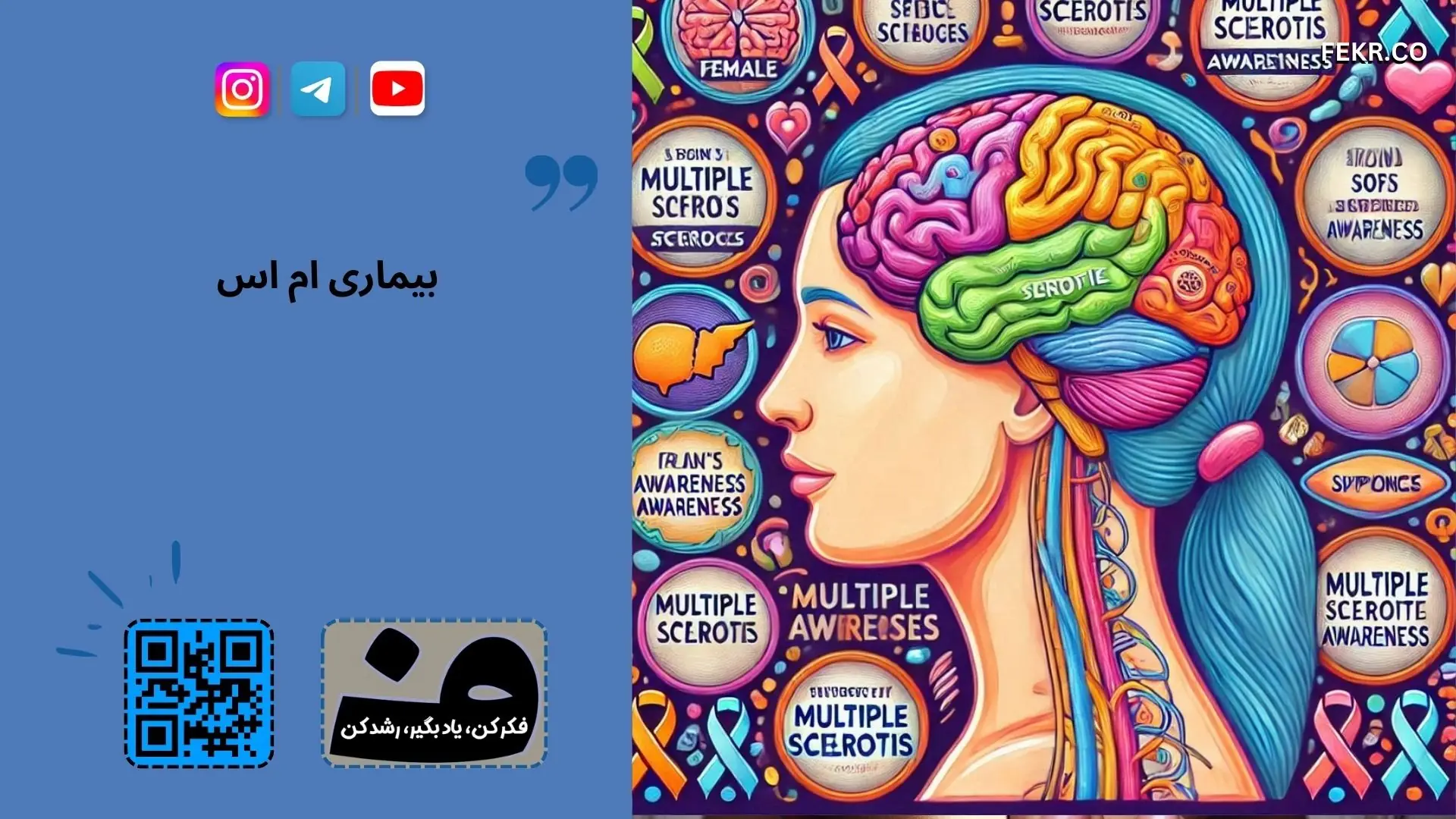 بیماری  MS چیست ؟