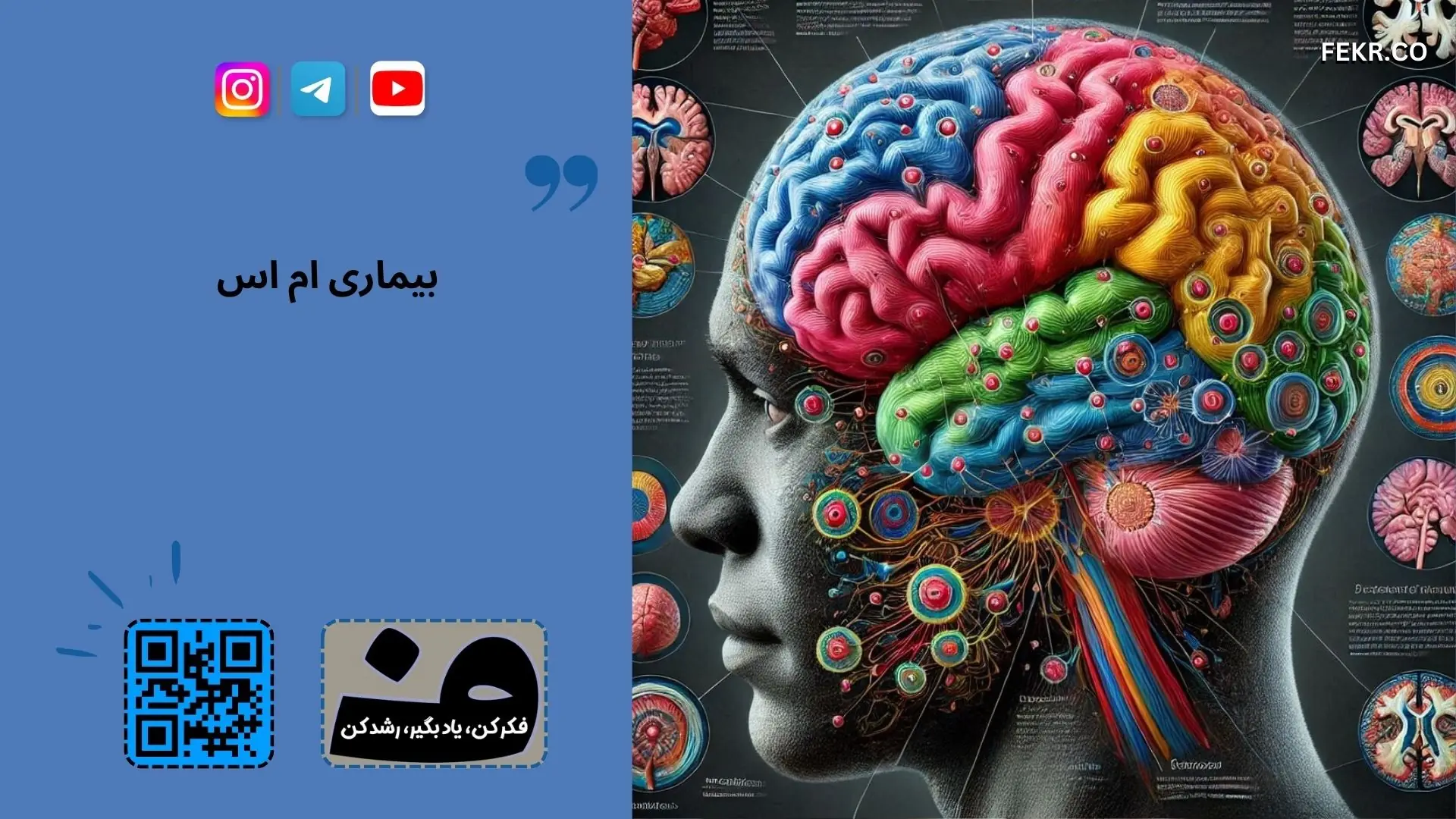 اولین نشانه‌هایی که باعث مراجعه بیماران مبتلا به ام‌اس (MS) به پزشک می‌شود، چیست؟