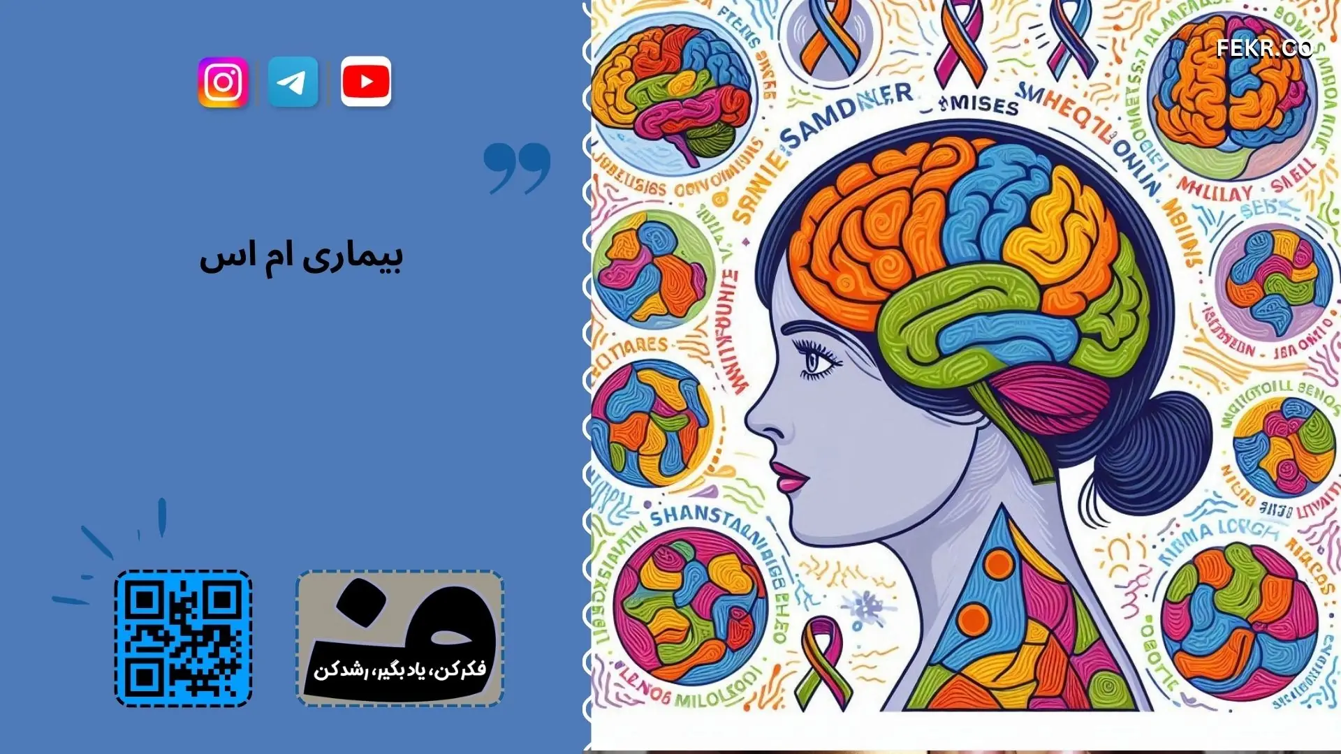 آیا بیماری ام اس متعلق به جنسیت خاص است؟