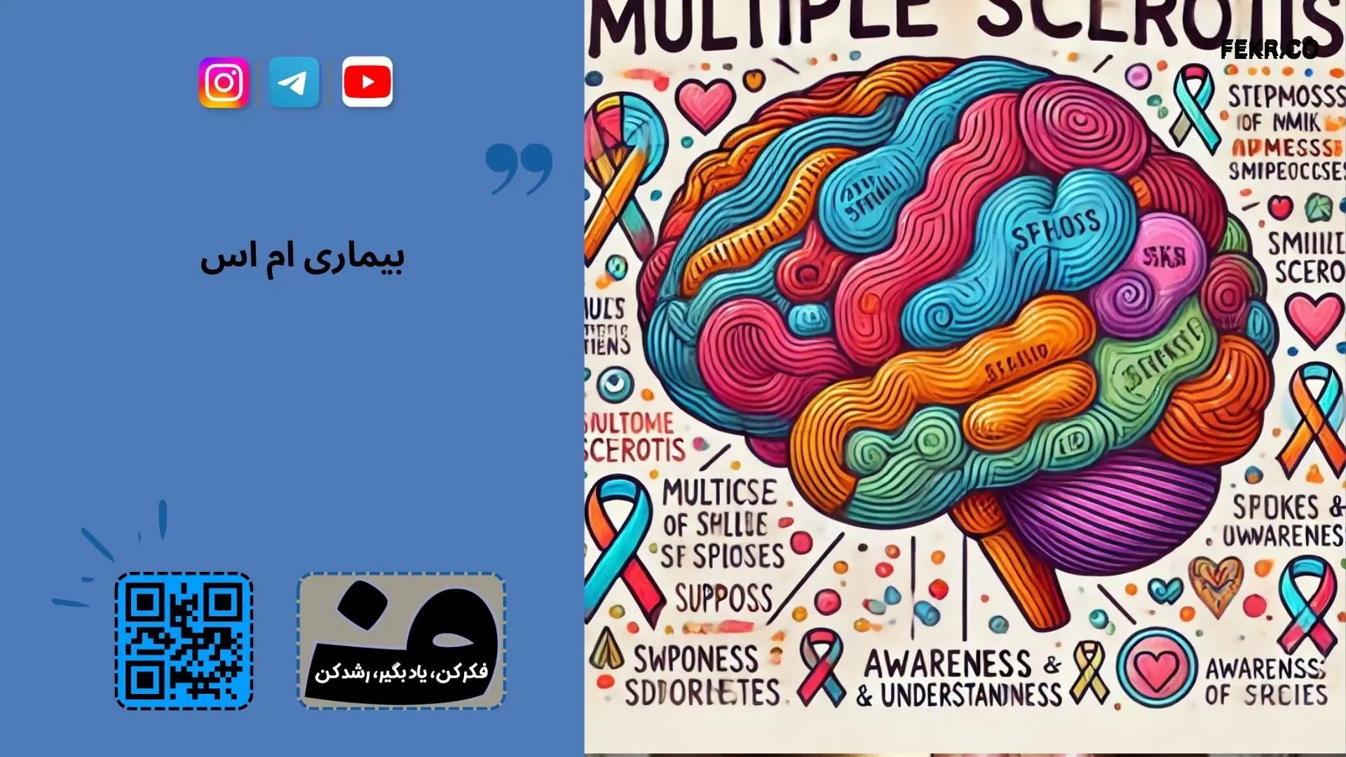 مغز در بیماری ام اس