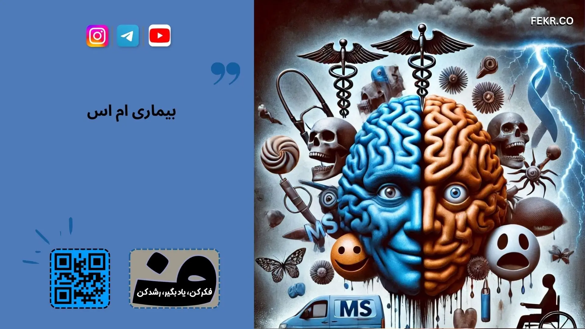 بیماری ام اس با چه بیماریهای دیگر اشتباه گرفته می شود؟